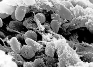 Credit:К Rocky Mountain Laboratories, NIAID, NIH  Scanning electron micrograph depicting a mass of Yersinia pestis bacteria (the cause of bubonic plague) in the foregut of the flea vector