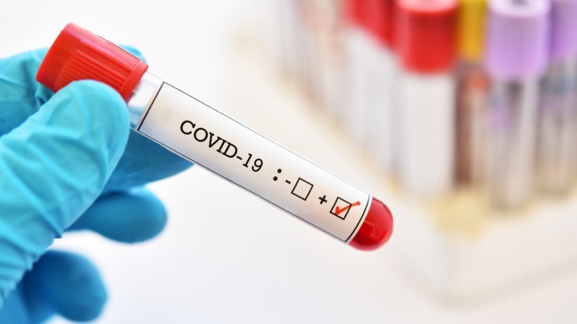 496 са новите случаи на коронавирус у нас Направени са над 6000 изследвания