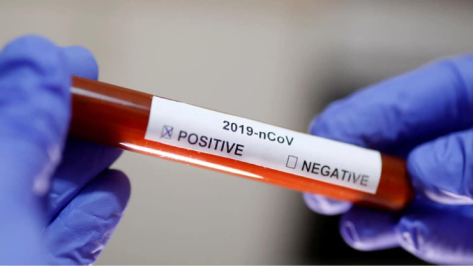 Новите случаи на коронавирус у нас за последното денонощие са 19