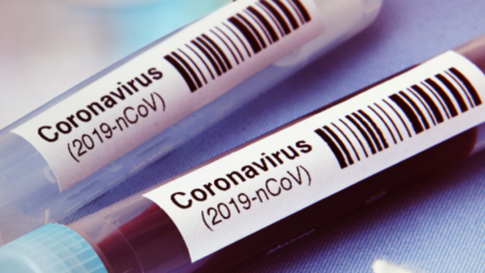 Новите потвърдени случаи на коронавирус у нас за последното денонощие са 65