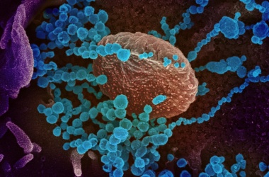 17 са новите случаи на коронавирус у нас