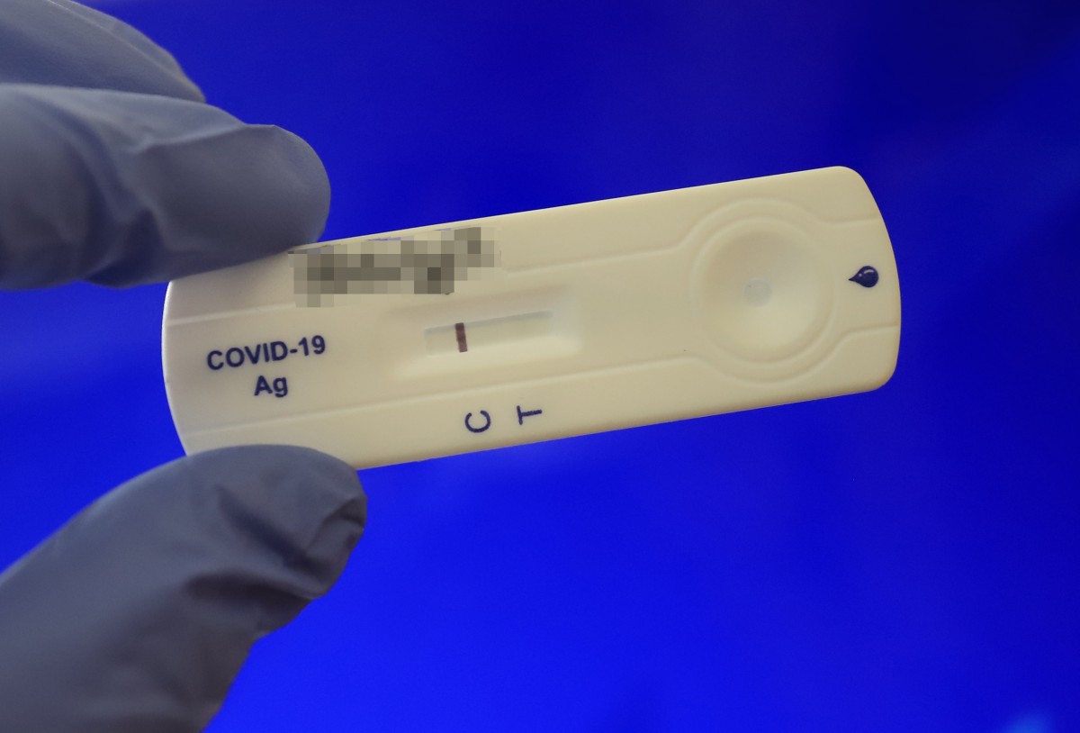 439 са новите случаи на коронавирус